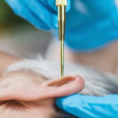 Auriculotherapy, or auricular treatment on human ear with flexible massage brass ear pen, close up. Acupuncture pressure on ear seed sticker.