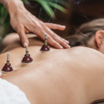 Moxibustion Traditional Chinese Medicine Treatment.  Hands of a practitioner placing a mugwort moxibustion therapy burning sticks on woman's back